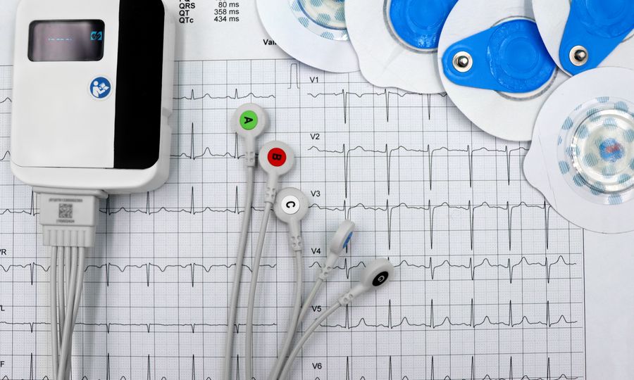 Close-up of an ECG device with electrodes and printed heart-rate readings
